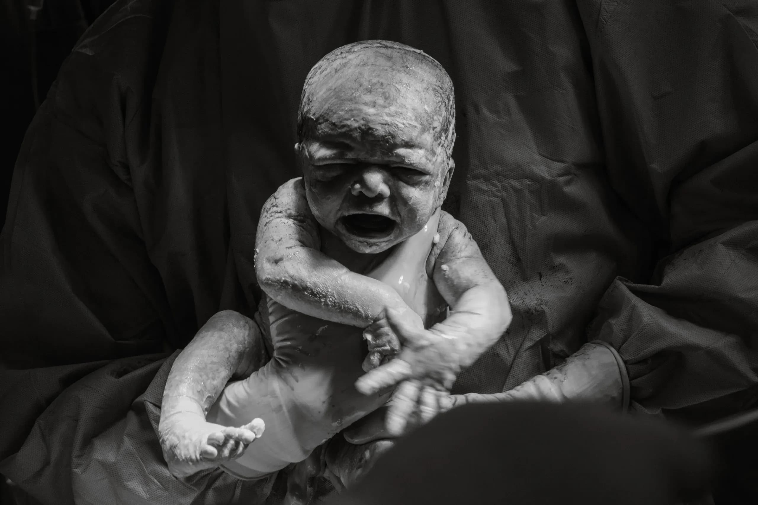 Birth photography — Love Clic & See